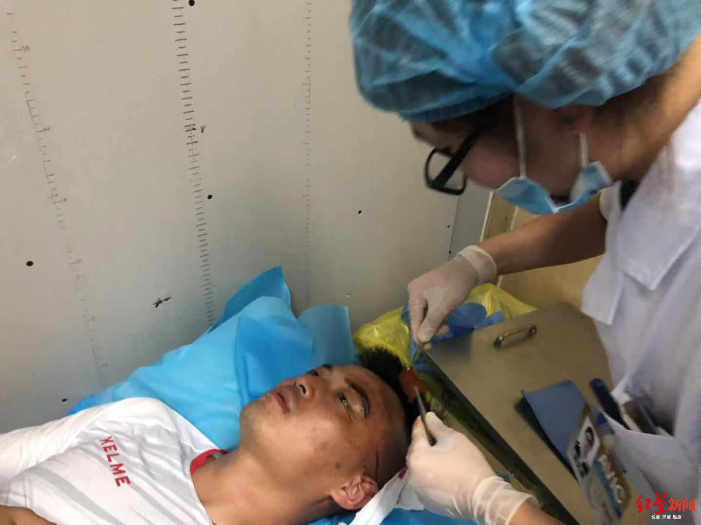 世警会温江民警眉骨撞破缝针未拆线继续比赛“裂开就再缝一次”