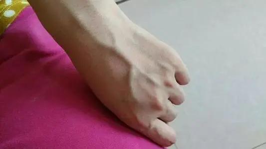 青筋明显说明肝脏出了大问题,青筋暴起的病