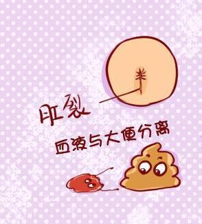 怎样判断新生儿宝宝大便是否正确,新生儿宝宝大便怎么判断是否正常