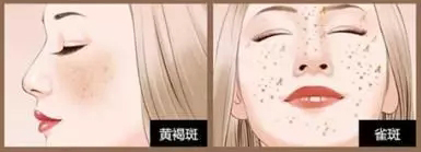 经常打美白针有什么副作用,打美白针到底有没有副作用