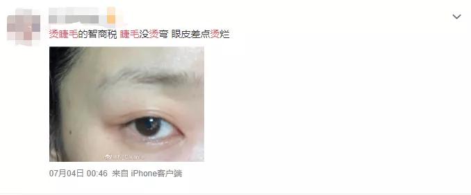 加热睫毛夹烫伤,棉签烧睫毛有啥征兆