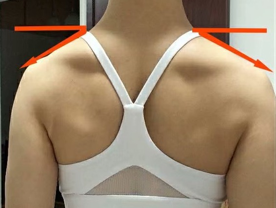 溜肩，长得再瘦体型也垮垮的。但溜肩常见这两种情况，别练错