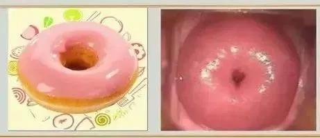 关于宫颈的那些谣言，你信过几个？——优秀科普作品展播