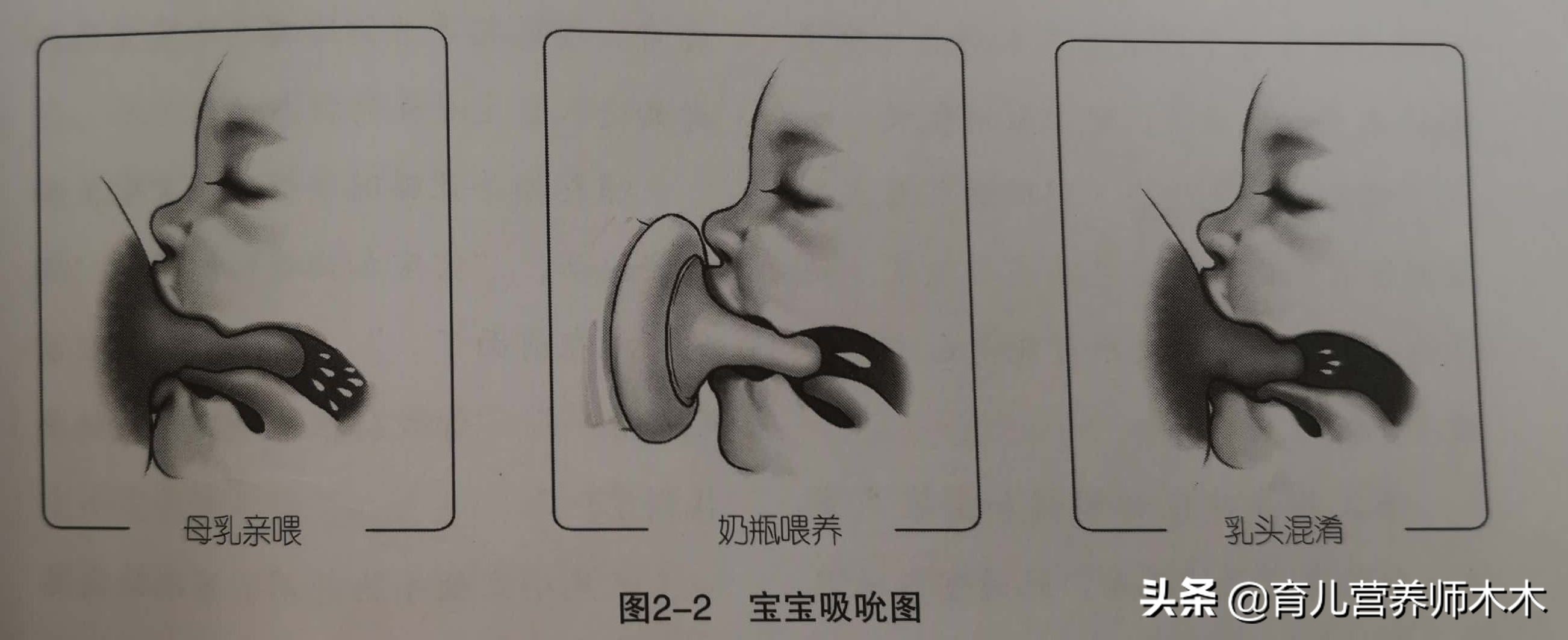 宝宝出生14天不吸母乳,40天宝宝不吸母乳吸奶瓶