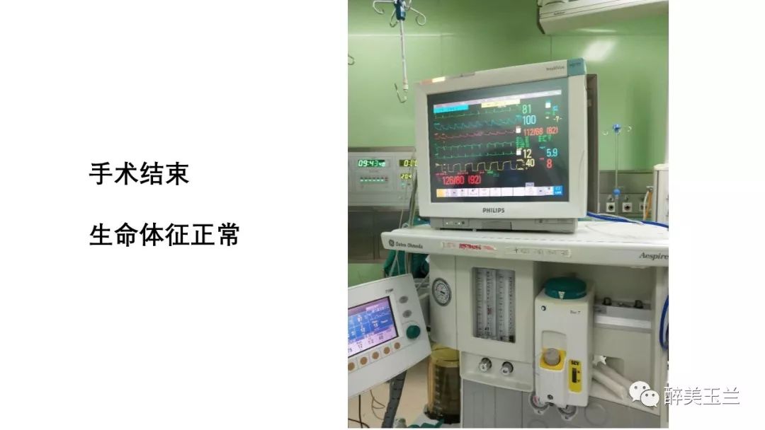 病例分享丨三叉神经节微球囊压迫术的麻醉管理