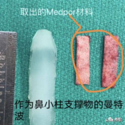 杨超越还能撑多久,杨超越遇到的真实事件