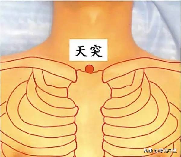 气虚型冠心病缓不过来气的急救穴,中医对心脏病的急救用穴是哪几个