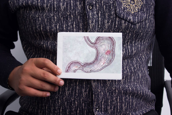 胃病是咋得的,什么是胃病的表现胃病的常见症状