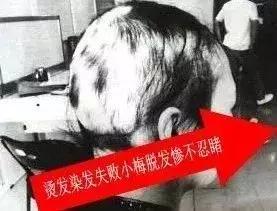 女人脱发,女性其实比男性秃