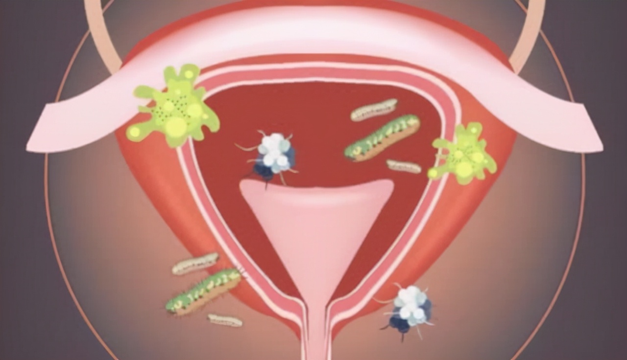 患有妇科炎症怎么办,患有妇科疾病的应该注意什么