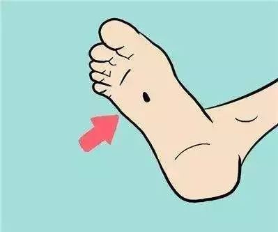 黑痣出现5个变化当心癌症,黑痣要怎么处理