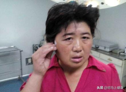 中药调理三叉神经痛的方子,杨以宁治疗三叉神经痛的方子