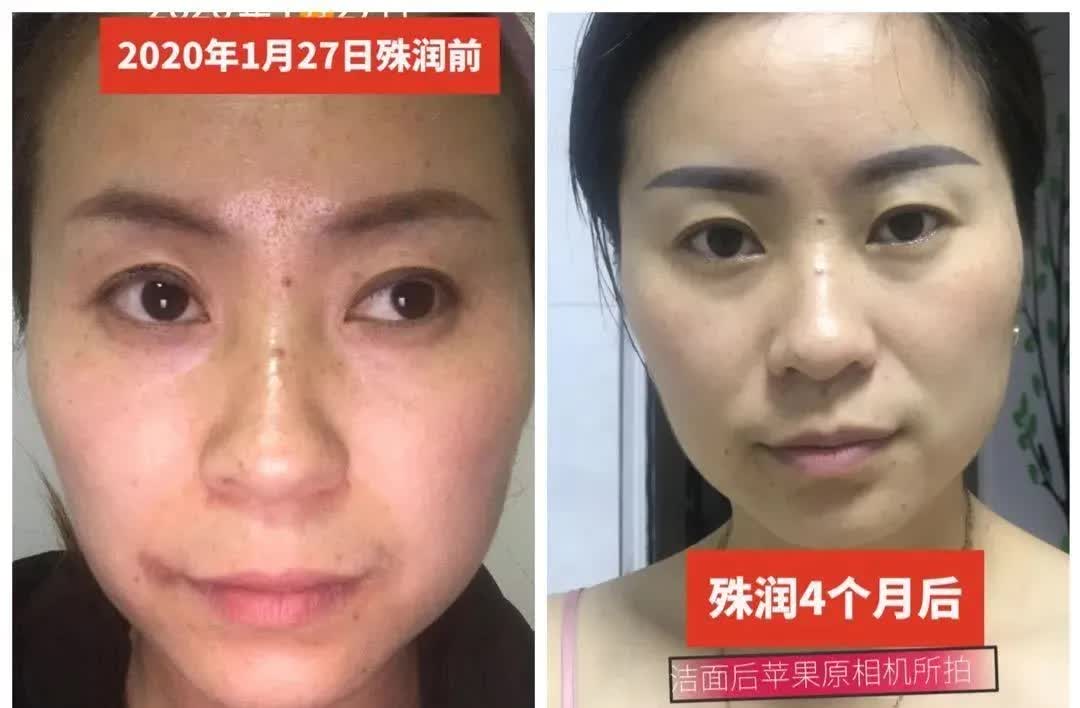 推荐好用的祛斑套盒,祛斑套盒推荐测评