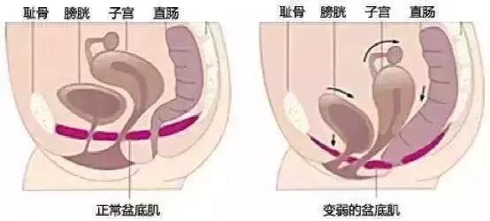 女人生宝宝要多痛,女人生孩子有没有损伤