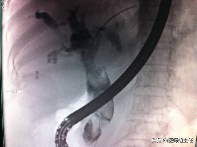 检查肝脏是b超好还是ct好,做肝脏彩超跟ct哪个贵