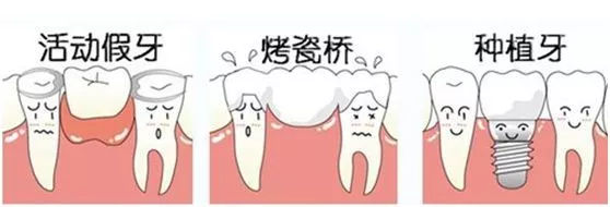 老人无牙了怎么装假牙,老人活动假牙