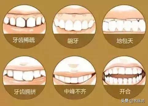 牙龈萎缩牙齿松动中医有什么方法,牙齿松动怎么办教你一招恢复