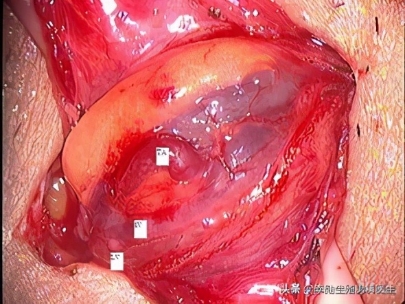 斩断三千烦恼丝英语,斩断三千烦恼丝方可破局