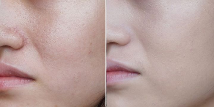 #护肤#气垫兰蔻菁纯气垫好用还是阿玛尼气垫好用？