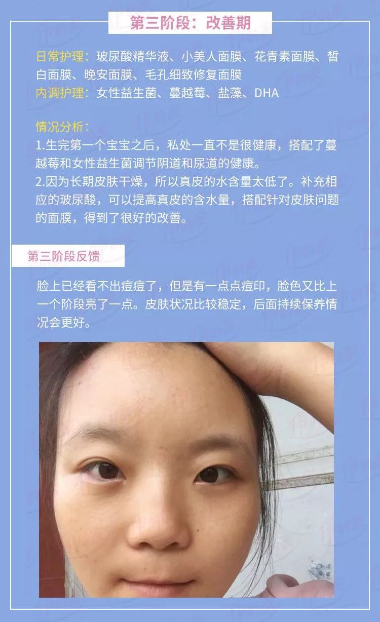 在成长的过程中，你是否也曾对自己的颜值不满意？