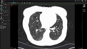 农场里走出CT鼻祖，美苏核危机诞生磁共振