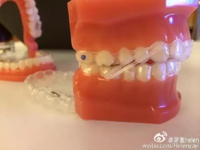 Helen榻跨涓績,寰峰浗鐗欓娇闅愬舰鐭