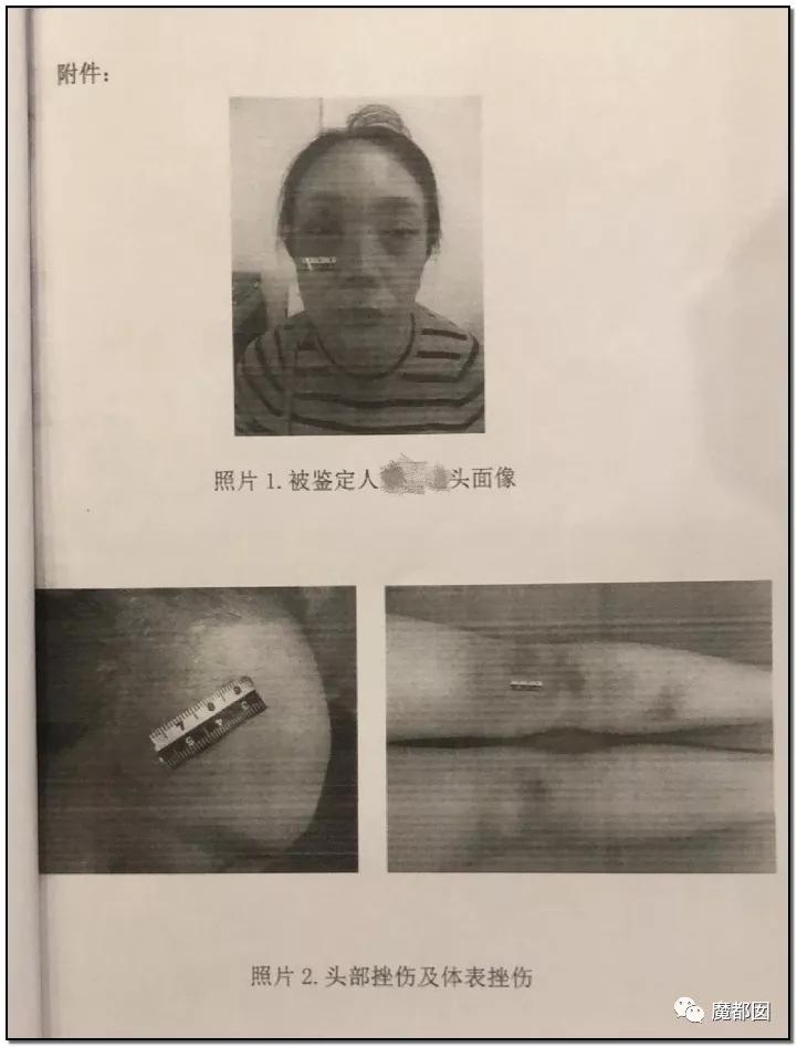 短跑名将张培萌被曝家暴反转,短跑名将张培萌家暴背后