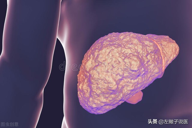 喝水多排尿少是肾出问题了吗,长期喝水少对肾脏的影响