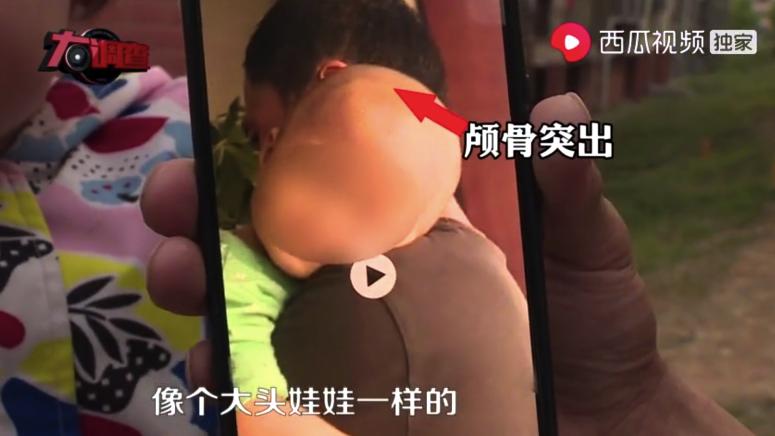 湖南把饮料当奶粉喝出大头娃娃 (湖南大头娃娃假奶粉事件)