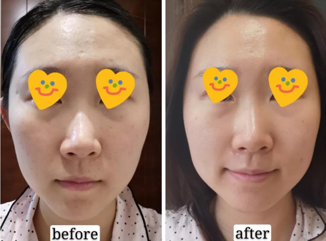 jm面膜燕窝精华好用吗,鱼子酱面膜和燕窝面膜哪种好用些