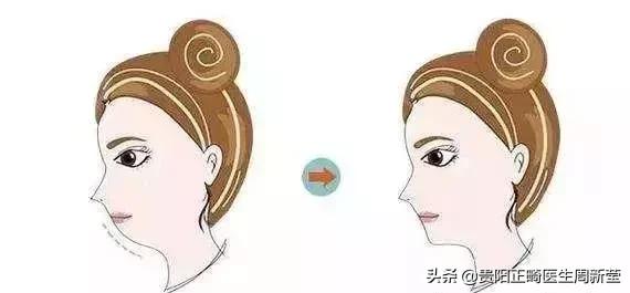 嘴形状看面相,嘴型区分