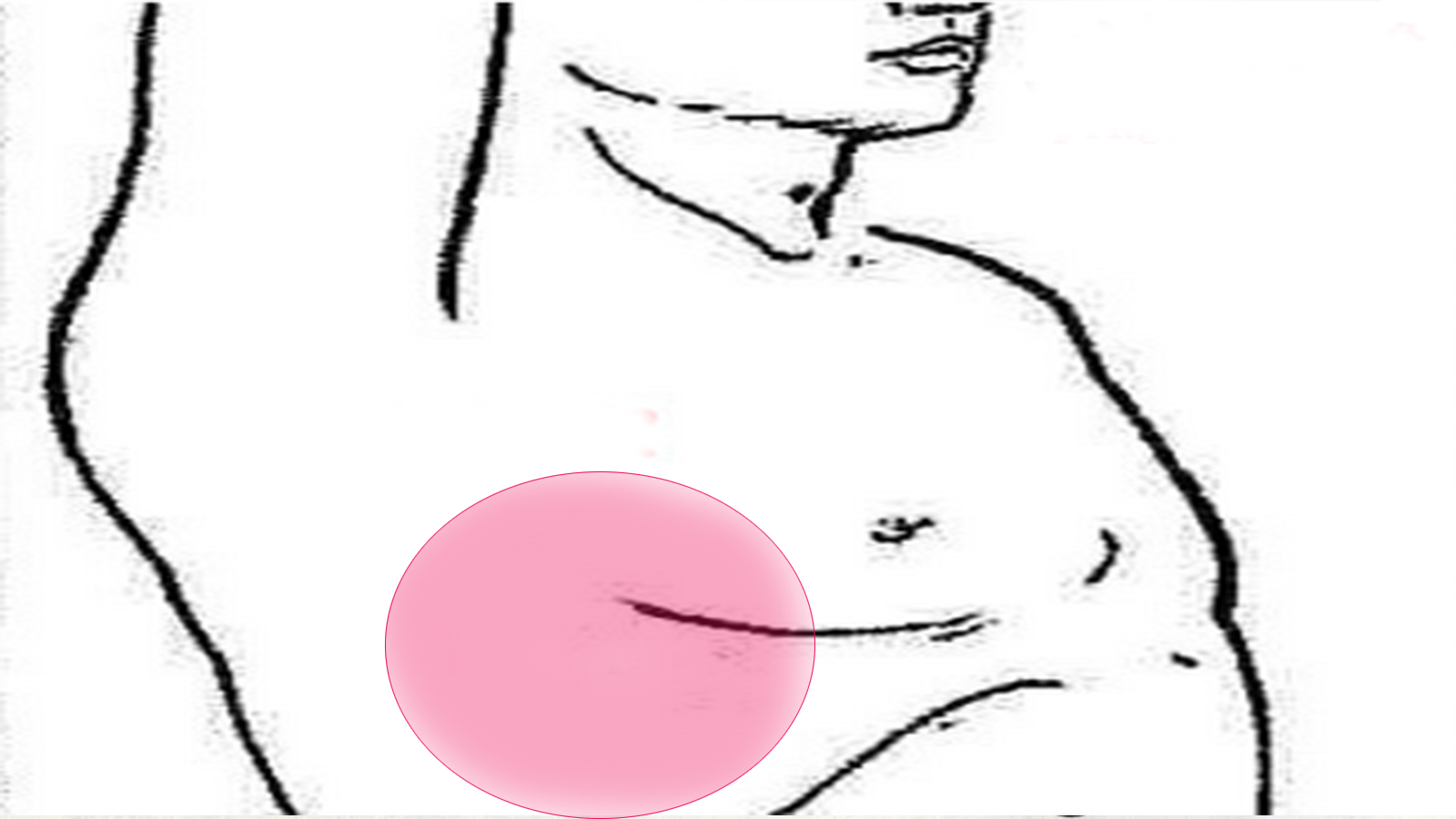 胸痛是不是肺炎,胸痛不一定是肺癌吧