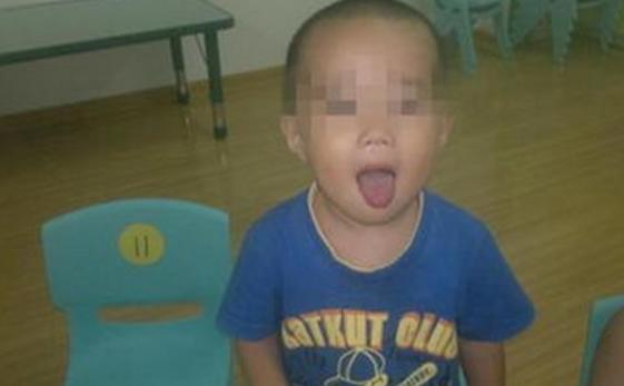 锻炼孩子口吃的语言游戏,解决幼儿口吃的策略