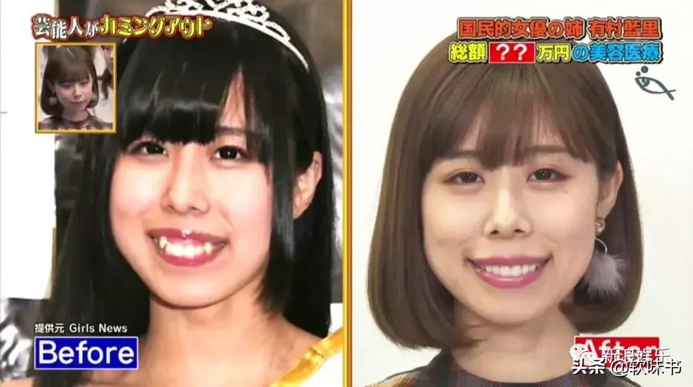 整容脸vs自然脸同龄女星对比,明明是整容脸却没被吐槽过