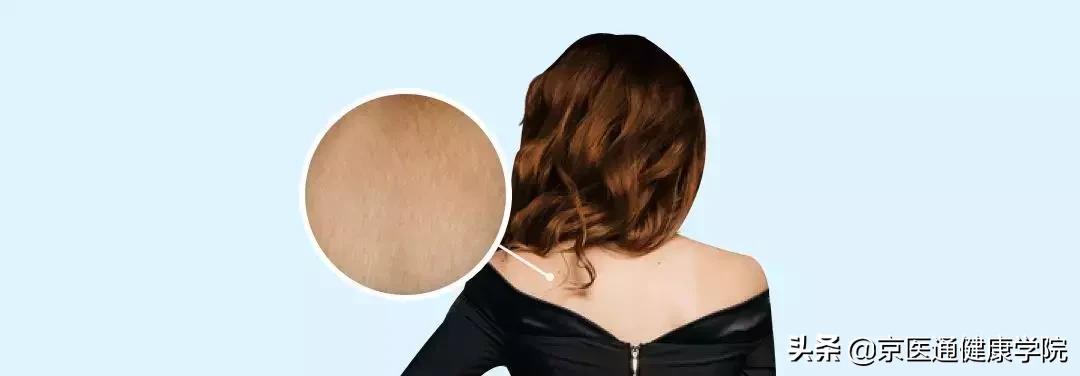 顽固湿疹痘痘,痘痘湿疹肌肤怎么改善