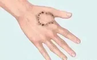 狂犬病疫苗48小时还有效吗,狂犬病疫苗48小时内打还有效吗