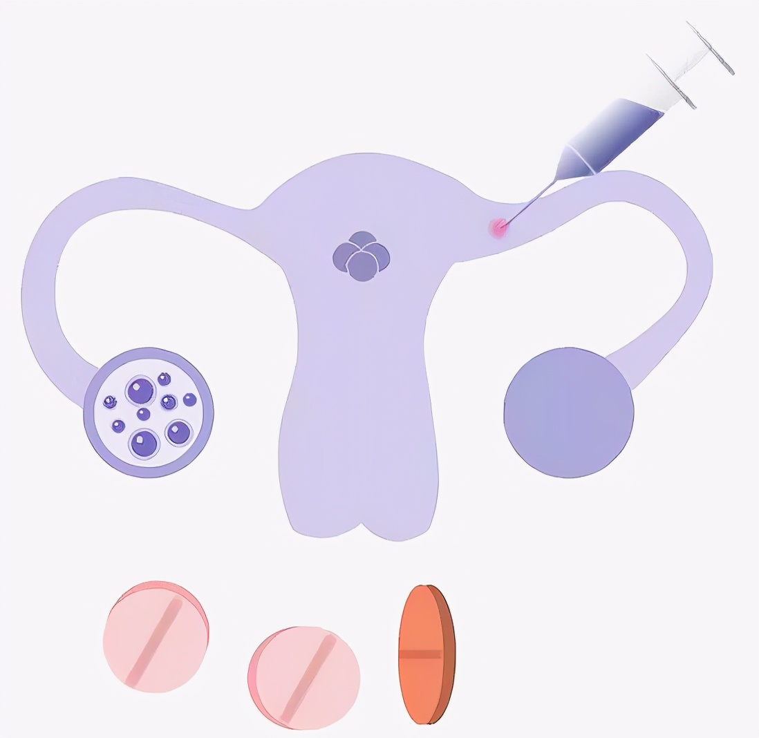 试管移植后紧张焦虑怎么办,移植后打游戏紧张影响着床吗