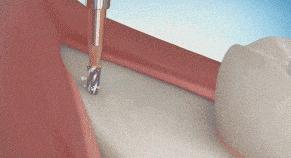 每个人都有多余的智齿,爱护自己的智齿