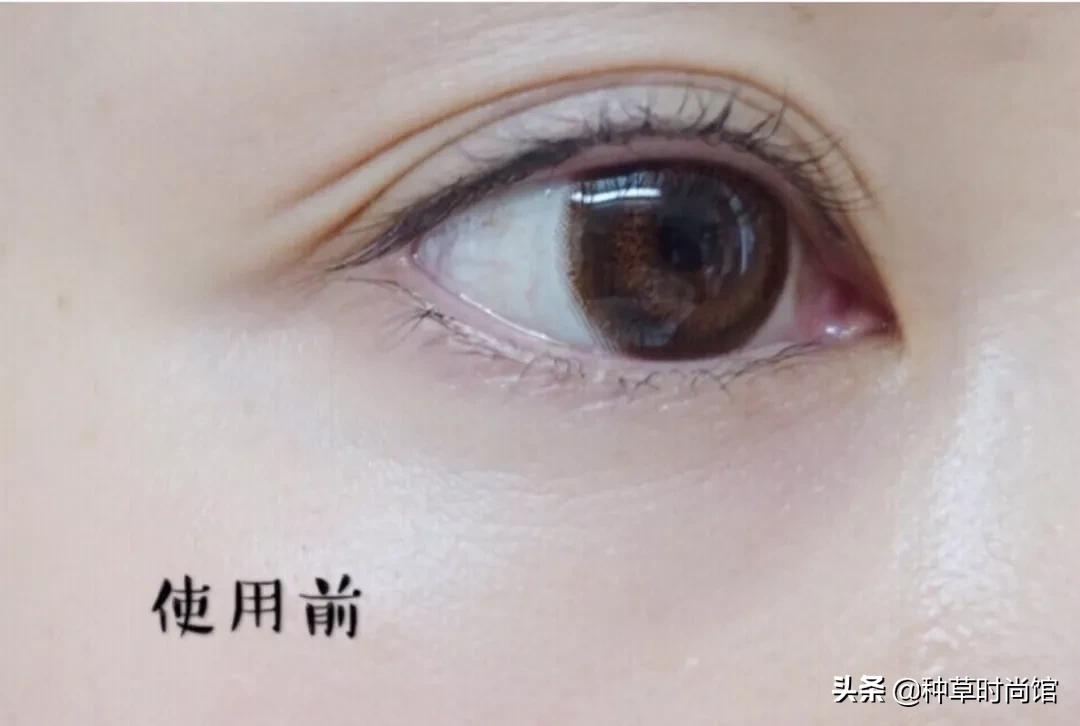 你的眼膜上白名单了吗？