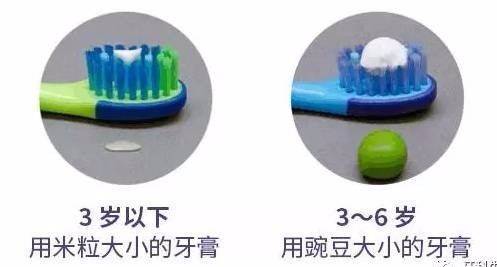 小孩乳牙有龋齿需要治疗吗,孩子乳牙门牙有点龋齿需要补牙吗