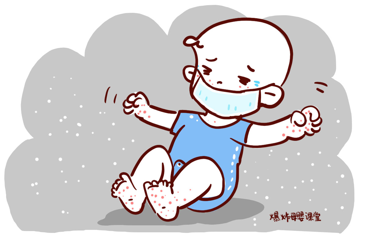 小孩对柳絮过敏吃什么药,小孩春季花粉过敏快速解决方法