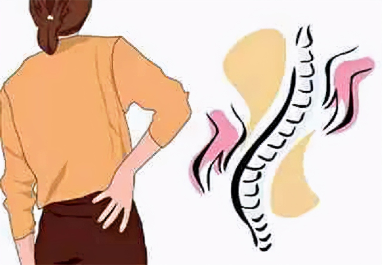 医生总结：椎间盘突出的原因和康复方法，简单实用不说，效果还好