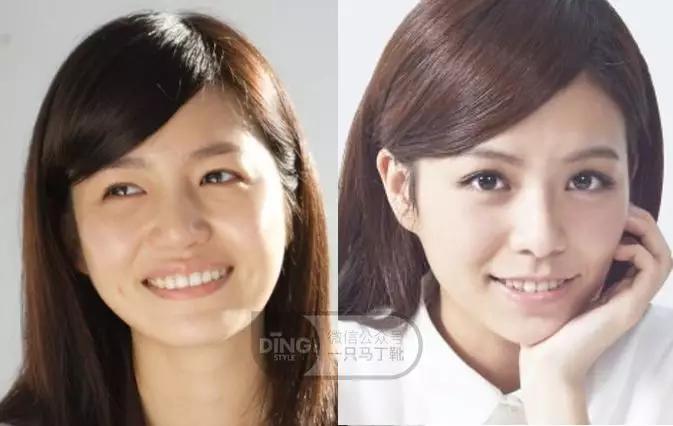 戴牙套凸嘴怎么化妆,凸嘴整牙削骨吗