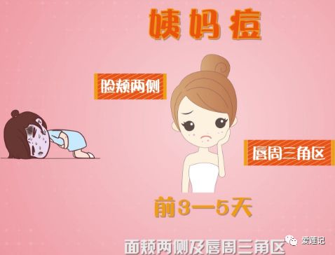 姨妈痘严重看什么科,姨妈痘应对大法