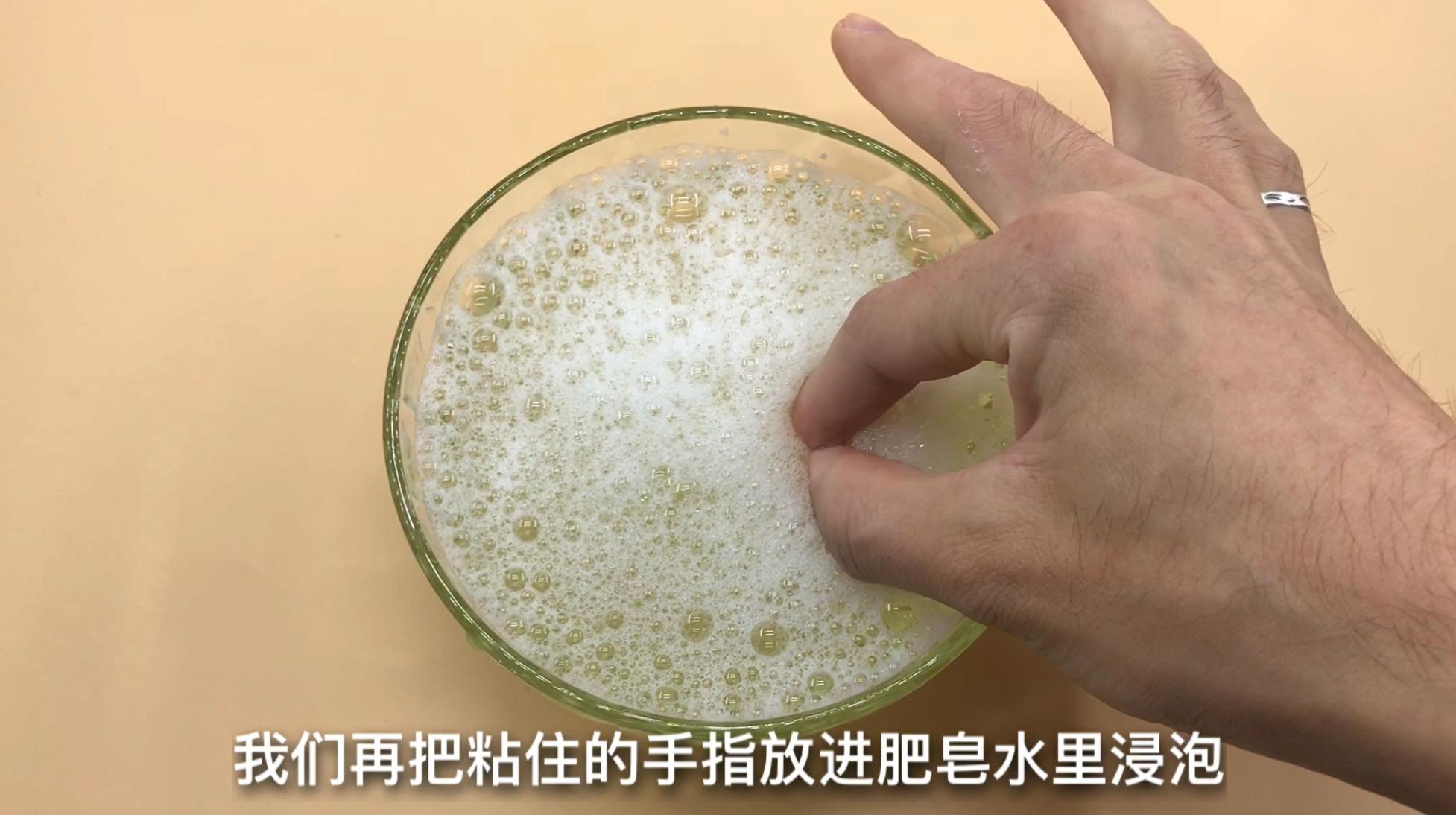 手指粘了502很久都好不了怎么办,502把手指和木棍粘在一起怎么办