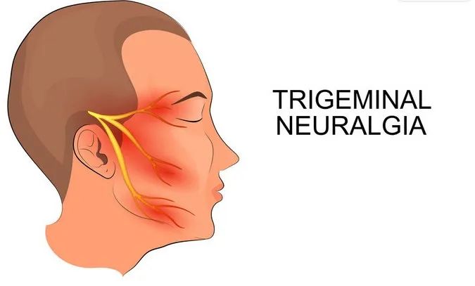 放疗能治愈的肿瘤有哪些,脑洞大开新疗法