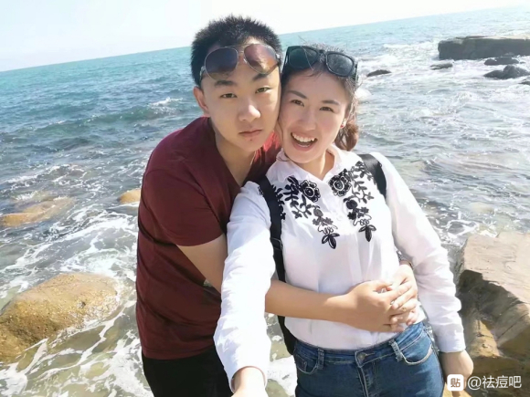 祛痘治疗后恢复,祛痘可以治好痘痘吗