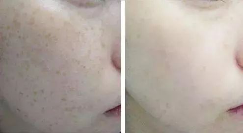 火到断货的“明星级”点斑笔,坚持每天点一下,14天养成初恋脸