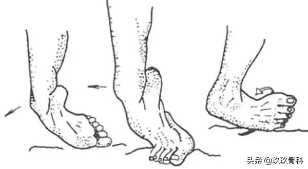 习惯性脚踝扭伤3年怎么治疗,习惯性扭伤脚踝隐隐作痛