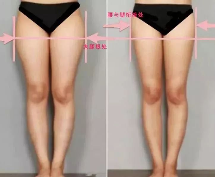 腿粗腿型不好如何改善,腿短而且大腿粗适合穿什么裤子